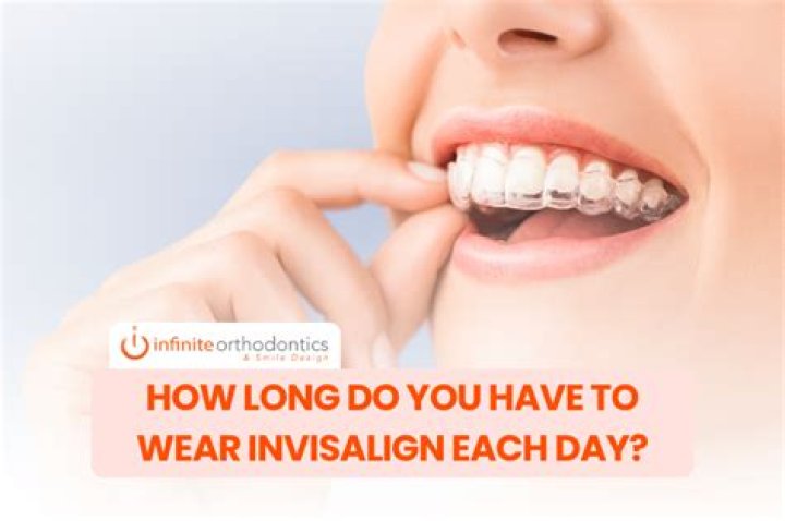 Do you wear Invisalign all day?