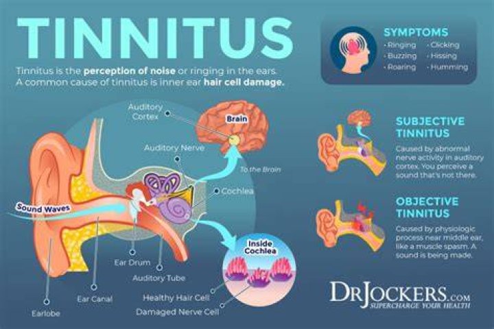 Does everyone have tinnitus in silence?