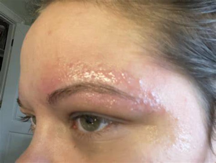 Does getting your eyebrows done hurt?