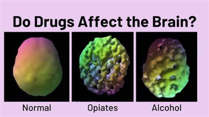 How do I know if drugs have damaged my brain?
