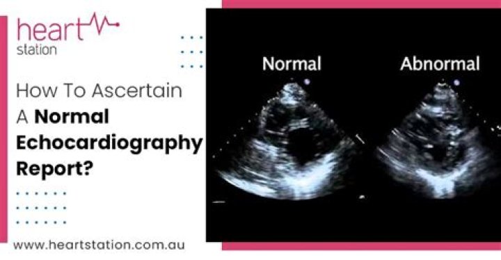 How do I know if my echocardiogram is normal?