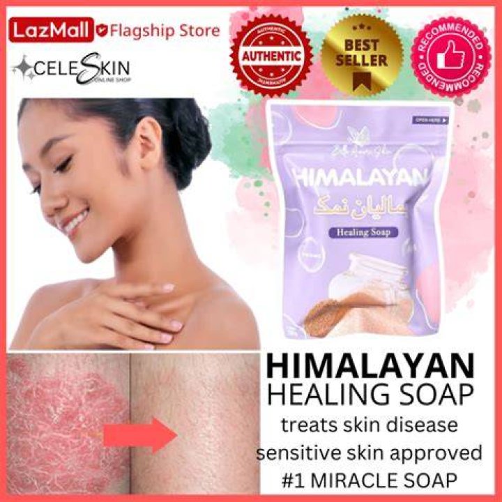 Is Himalayan salt good for eczema?