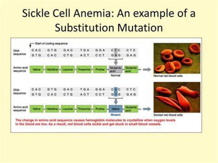 Is Sickle Cell Anemia a substitution mutation?