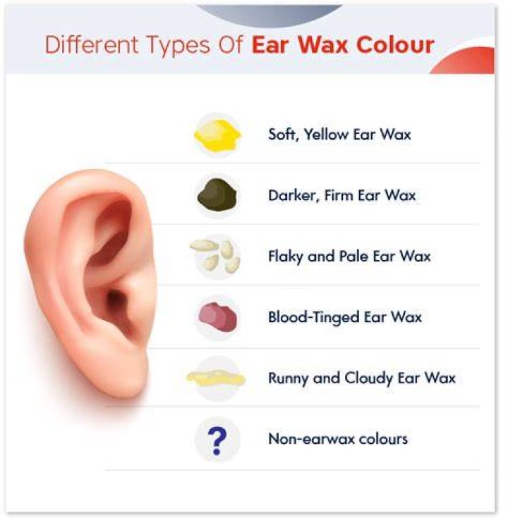 What Colour is baby ear wax?