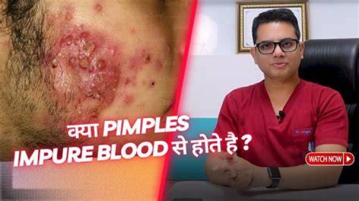 What does it mean when you pop a pimple and blood comes out?